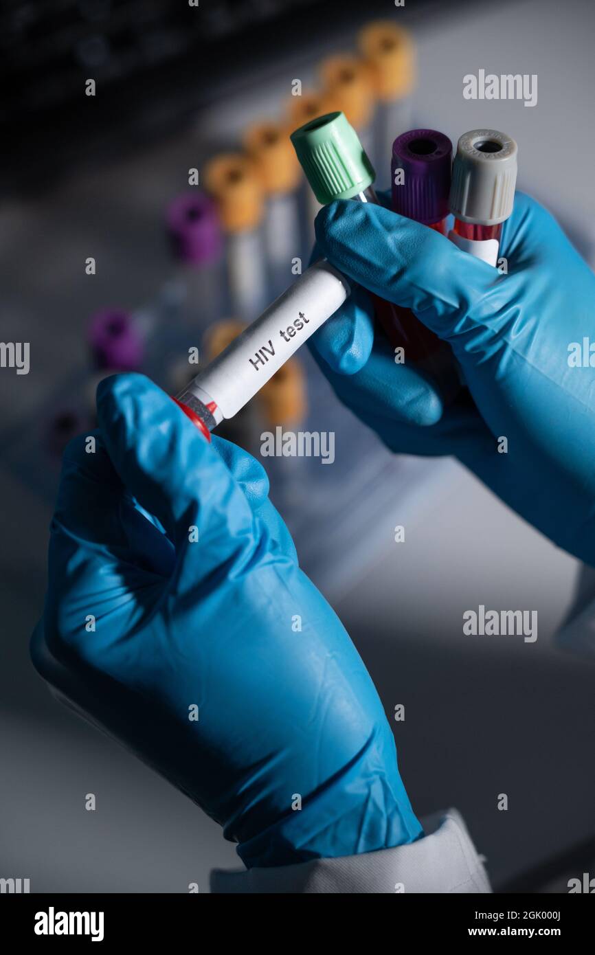 Tests sanguins pour détecter les maladies sexuellement transmissibles ou MST : hépatite B et C, syphilis, VIH. Banque D'Images