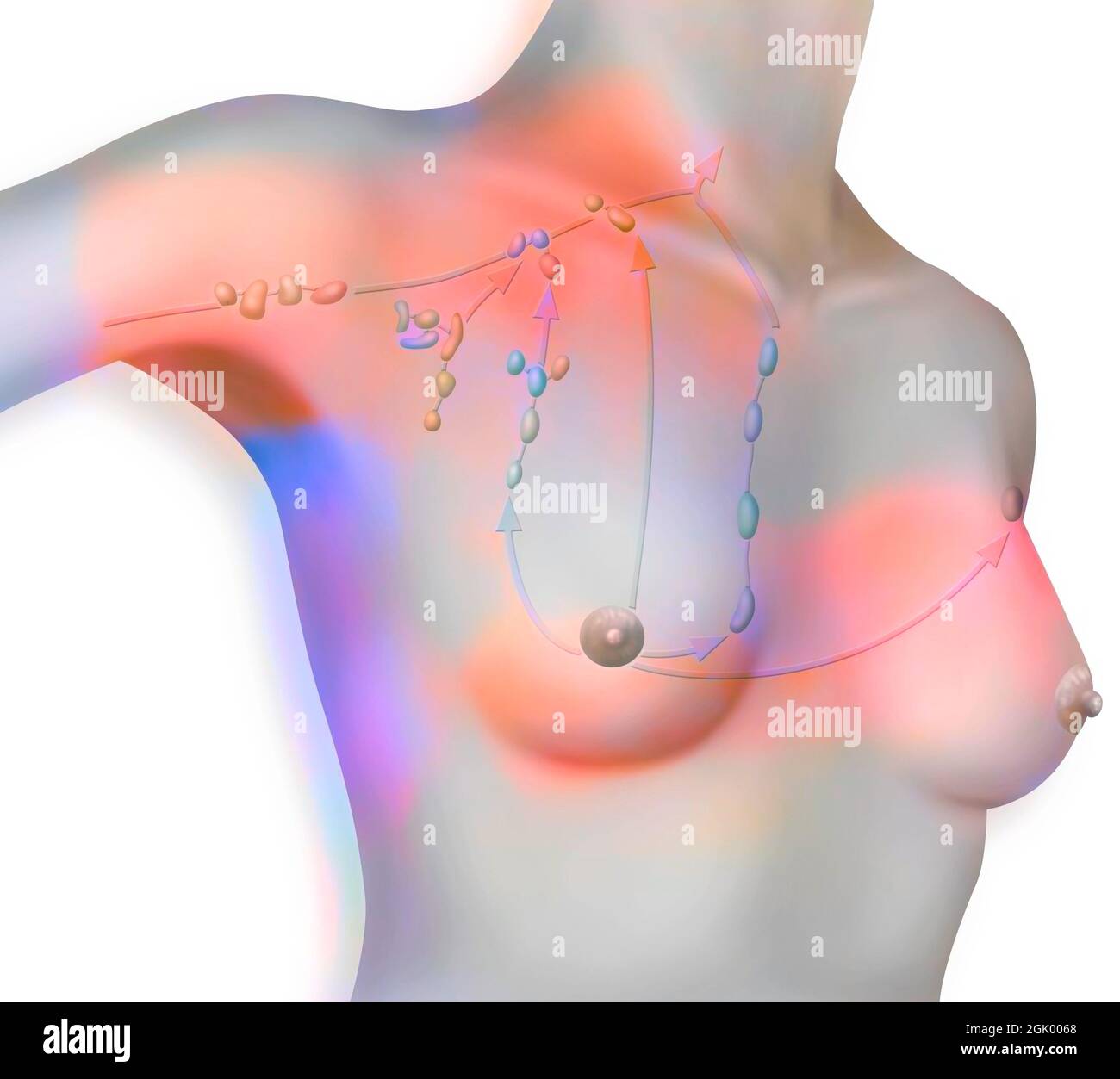 Chaîne de ganglions lymphatiques axillaires et thoraciques dans un buste de femme. Banque D'Images