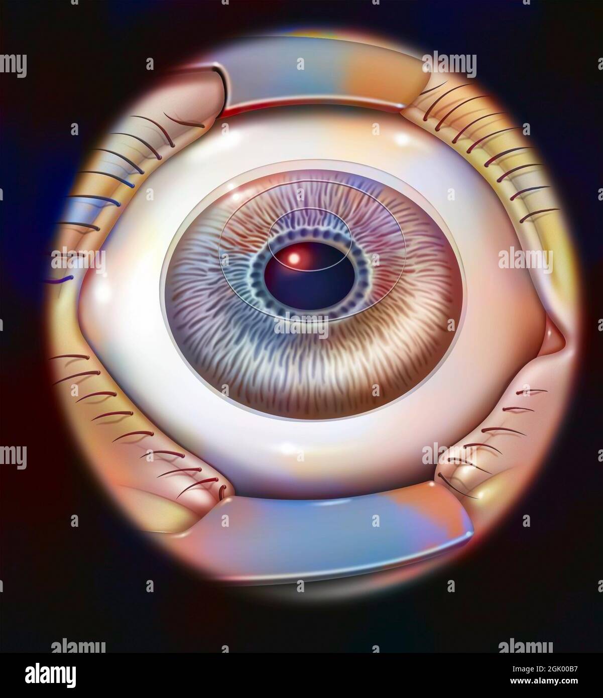 Oeil, presbylasik: Application de Lasik à la correction de presbytie. Banque D'Images