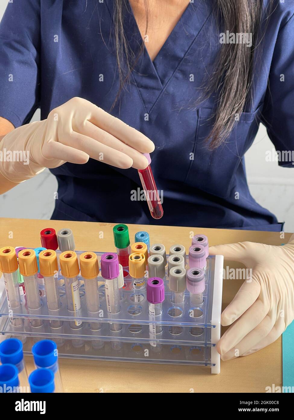 Le test sérologique est effectué avec un test sanguin pour rechercher la présence d'anticorps contre le virus Banque D'Images