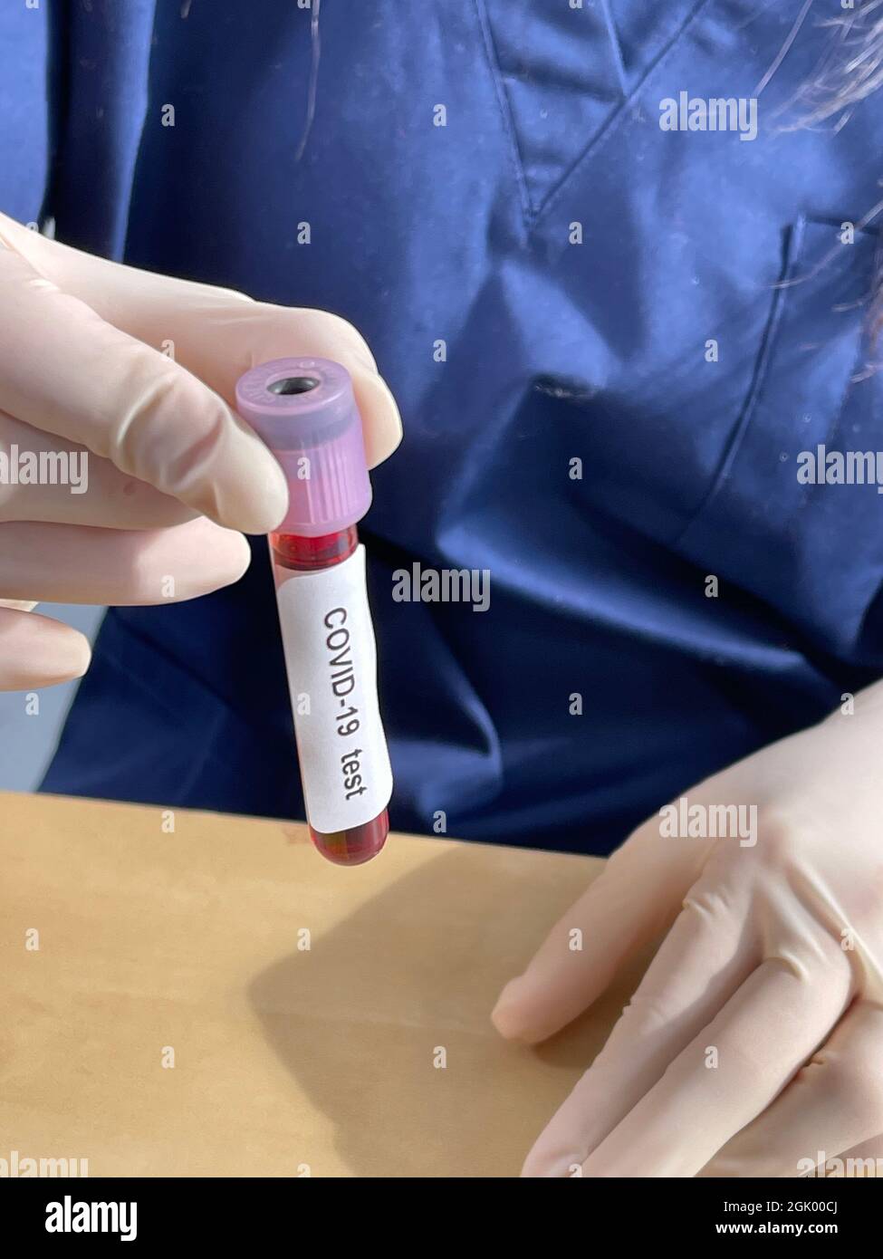 Test sérologique Covid-19 avec un test sanguin pour rechercher la présence d'anticorps. Banque D'Images