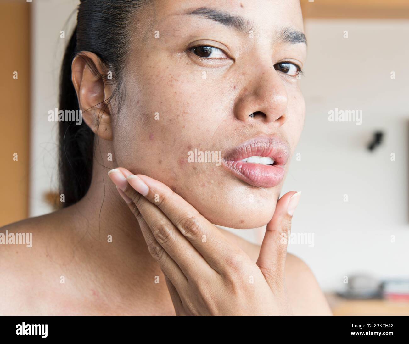 Les femmes qui ont des problèmes avec la peau sèche et se tournent vers la  peau qui est fragile, ou la peau très grasse jusqu'à ce que le maquillage  refuse de rester