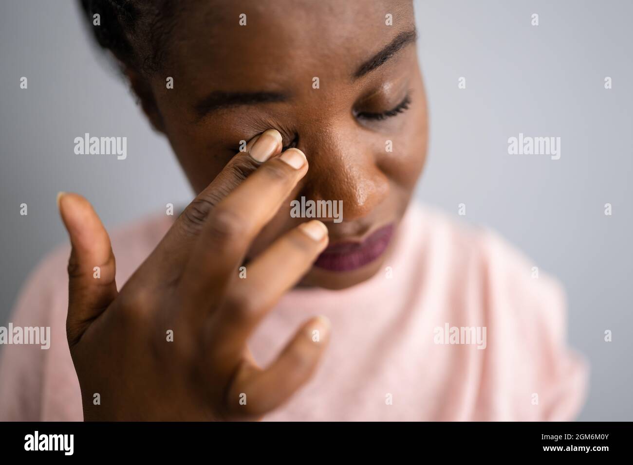 Douleurs oculaires et spasmes. Visage de fille avec démangeaisons Banque D'Images