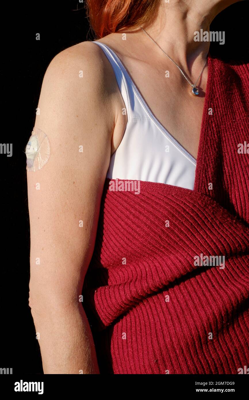 femme portant un patch bluetooth sur le bras pour envoyer des informations à sa pompe à insuline mobile medtronic surveillant les taux de sucre dans le sang pour le diabète Banque D'Images