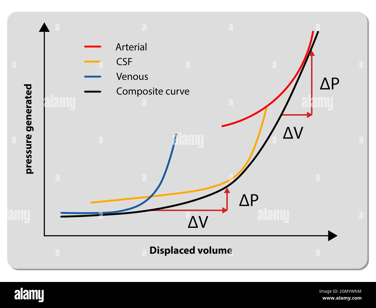 Courbe de volume de pression, augmentation de la pression intracrânienne, lcr, volume artériel, volume veineux, courbe composite, illustration graphique 2d Banque D'Images