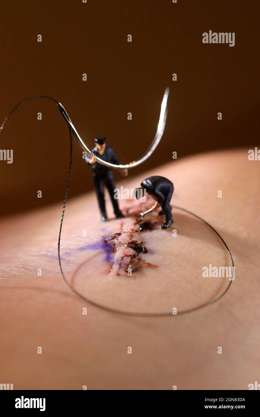 Les points de suture de chirurgie sont des poignées par des figures miniatures de l'échelle HO Banque D'Images