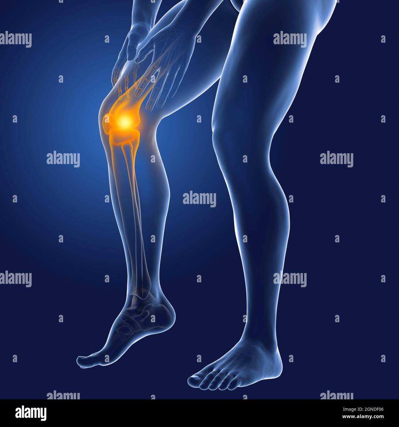 Les douleurs au genou, illustration Banque D'Images