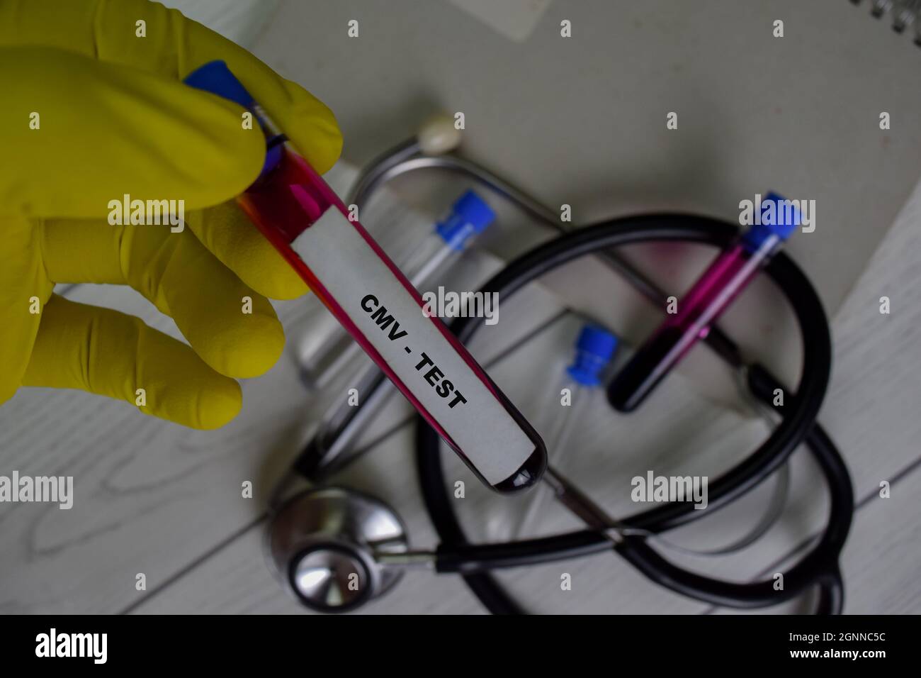 CMV - Test avec échantillon de sang. Vue de dessus isolée sur le bureau. Concept de santé ou de médecine Banque D'Images
