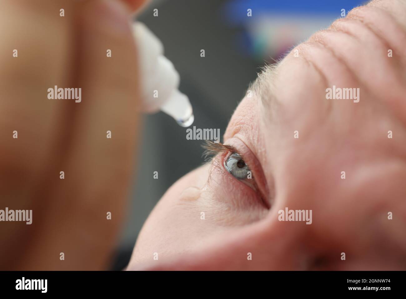 L'homme souffrant d'allergie cutanée digue les gouttes médicales dans les yeux Banque D'Images