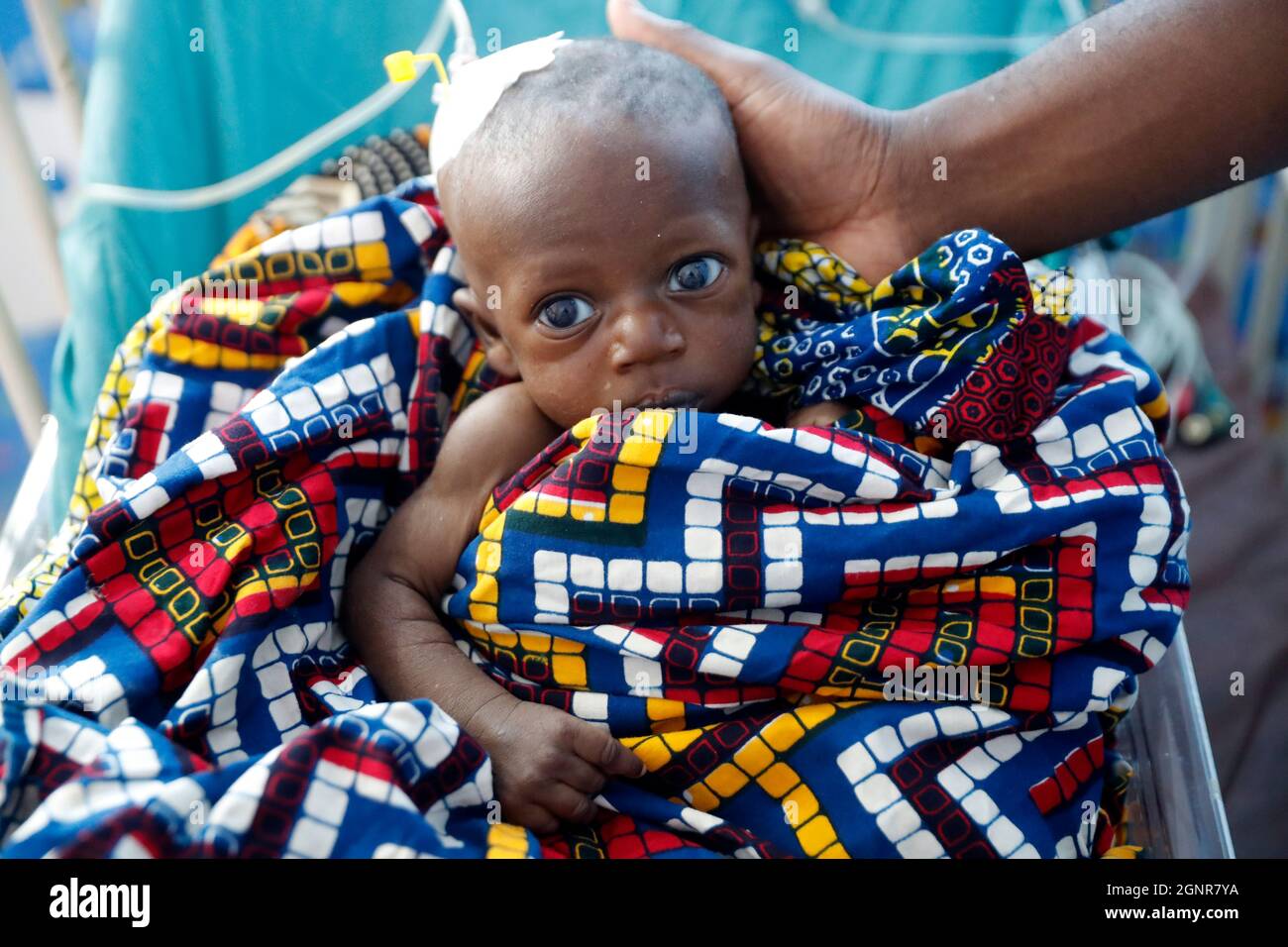 Hôpital africain. Service pédiatrique. Enfant en unité de soins intensifs. Bénin. Banque D'Images