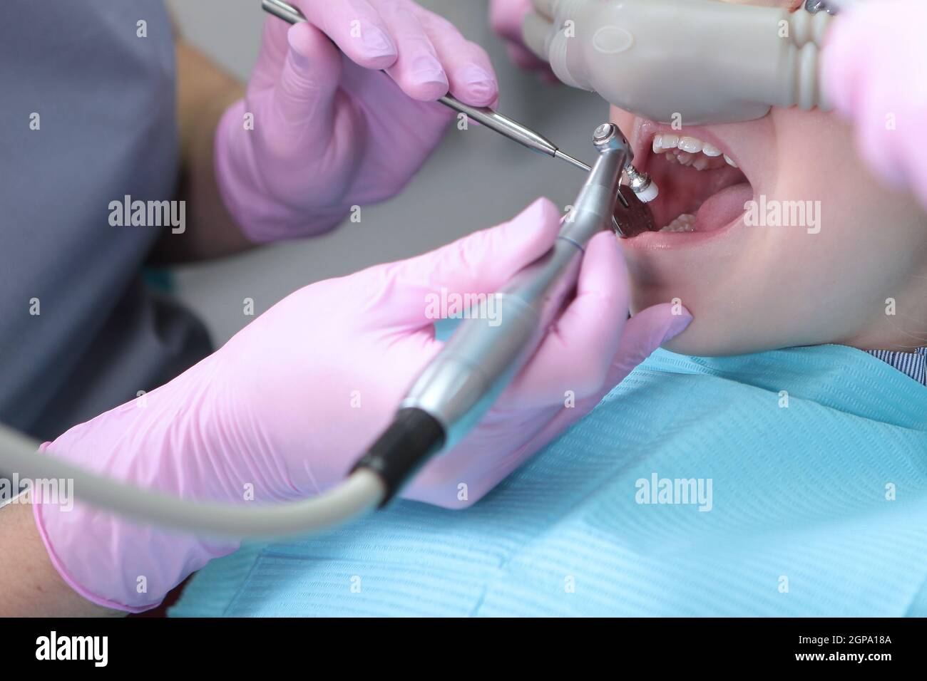 Traitement dentaire chez un enfant avec l'utilisation d'oxyde nitreux. Relaxation du patient avant les interventions chirurgicales ou dentaires. Dentisterie moderne pour enfants Banque D'Images