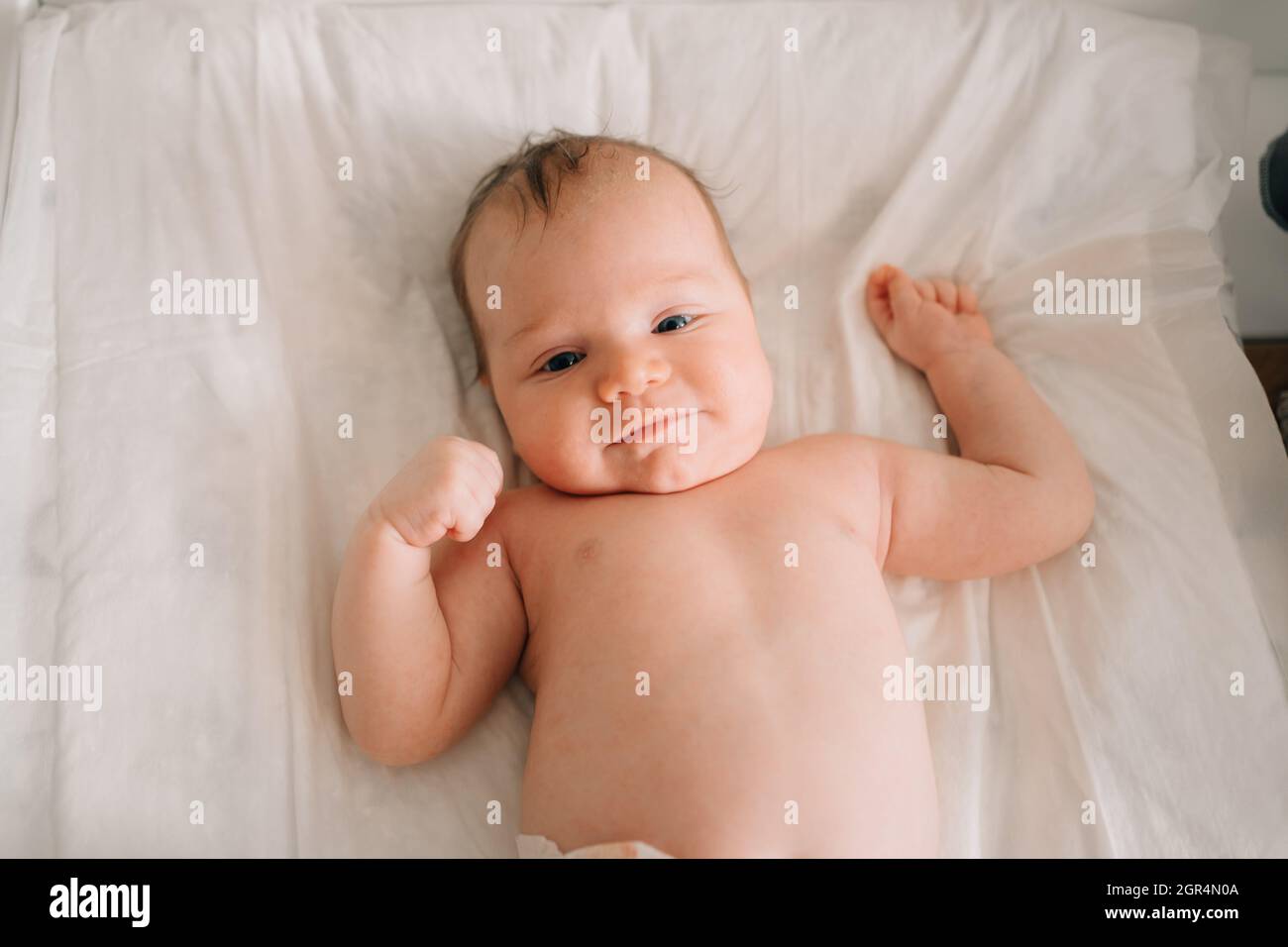 Un Bebe Avec Une Dermatite Seborrheique Sur Sa Tete Repose Sur Une Feuille Blanche Garde D Enfants Dermatologue Photo Stock Alamy