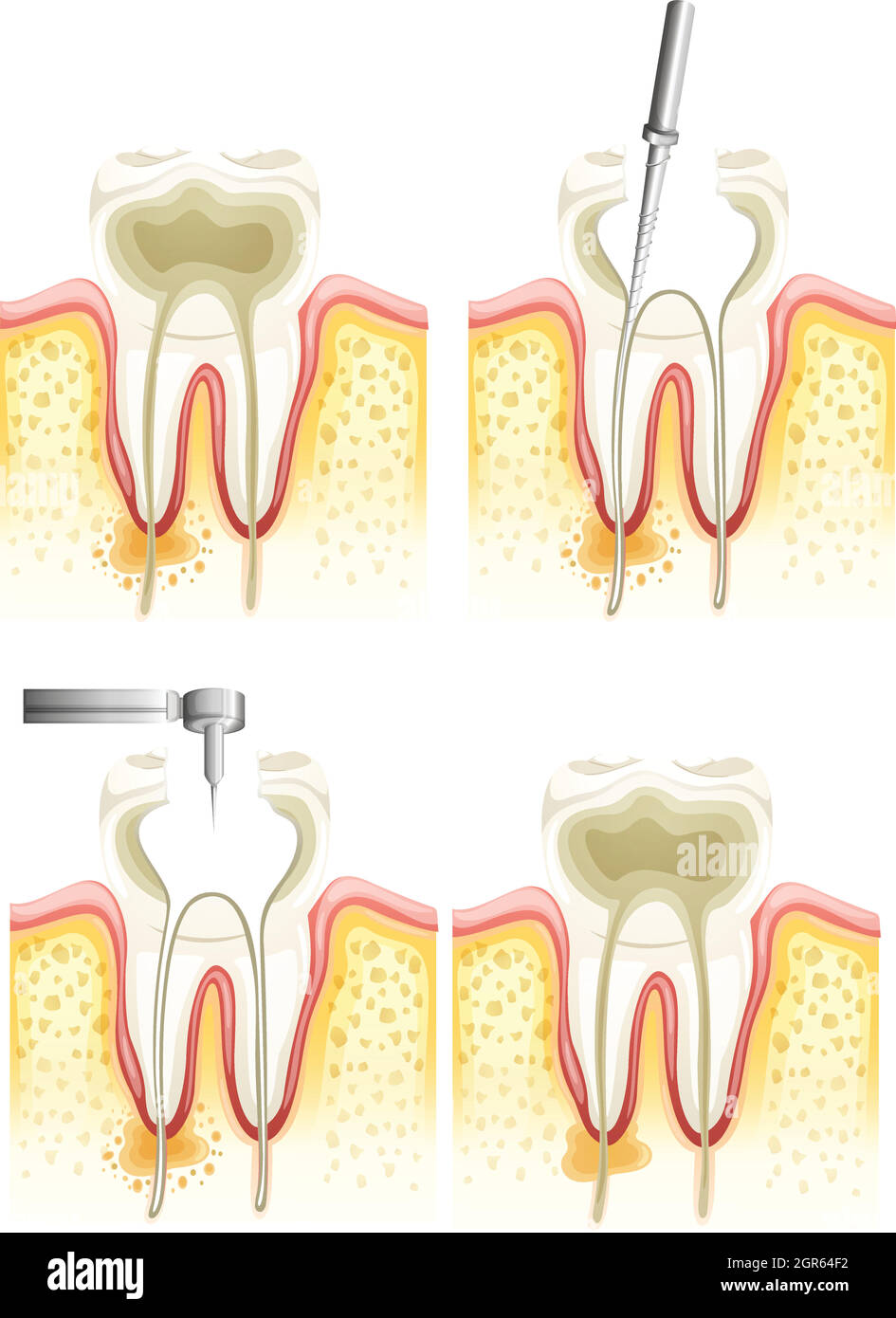Processus de canal racine Illustration de Vecteur
