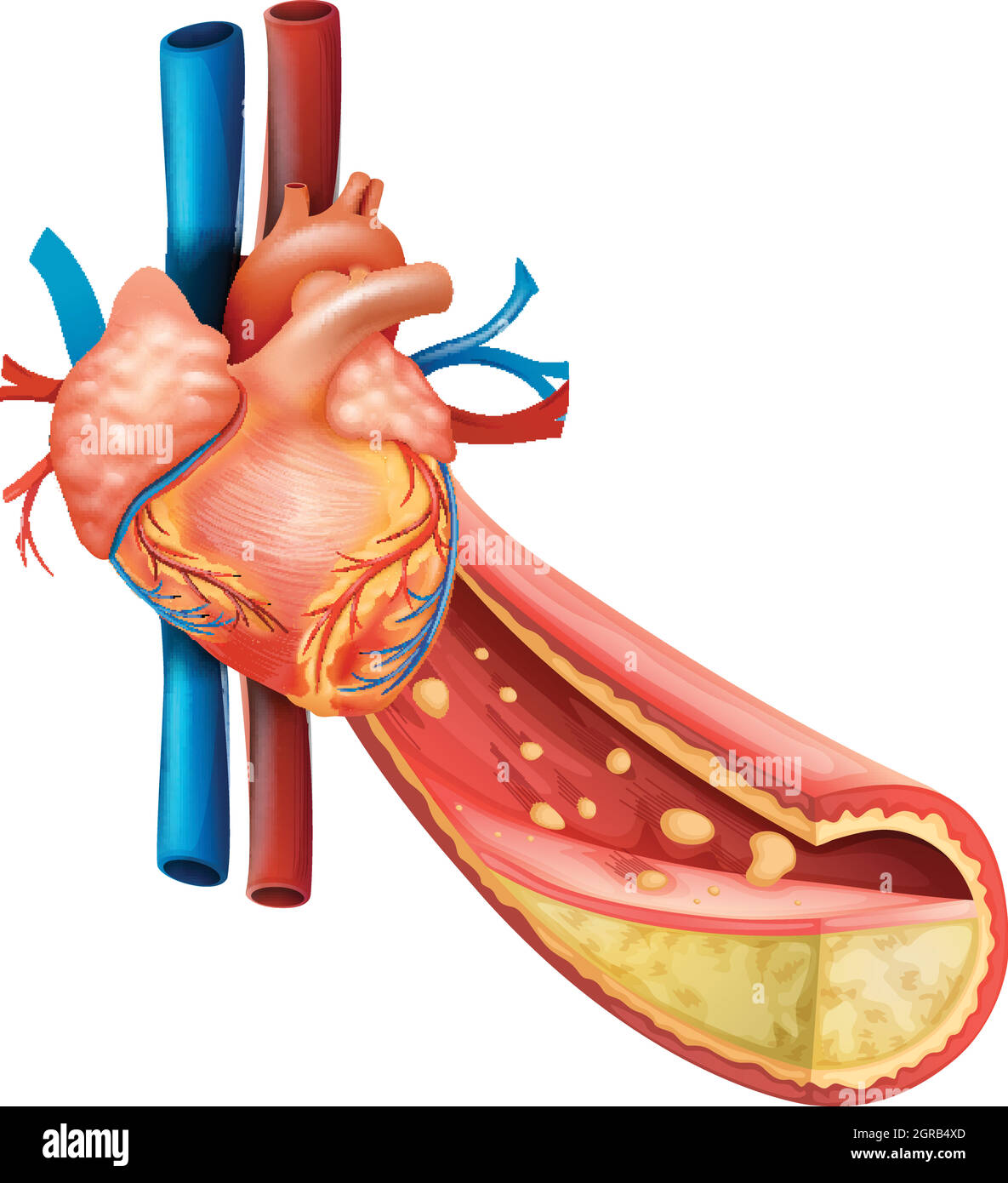 Diagramme montrant le cœur humain et les veines de graisse Illustration de Vecteur