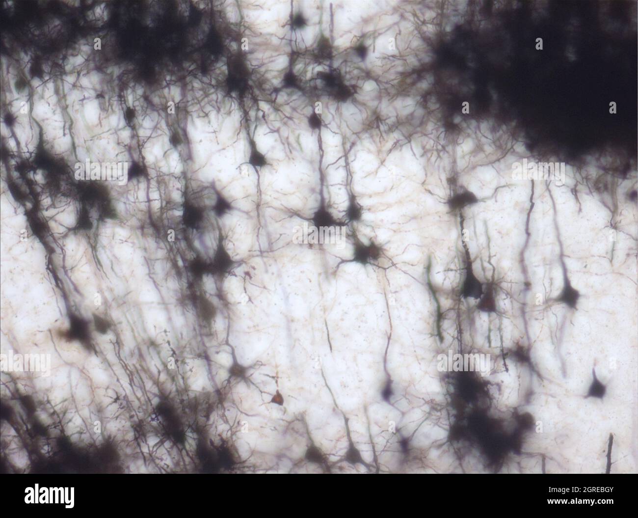 La section du cerveau de la souris a été colorée avec la coloration de Golgi, une technique du XIXe siècle qui a été largement utilisée jusqu'à récemment - et est parfois encore. Banque D'Images