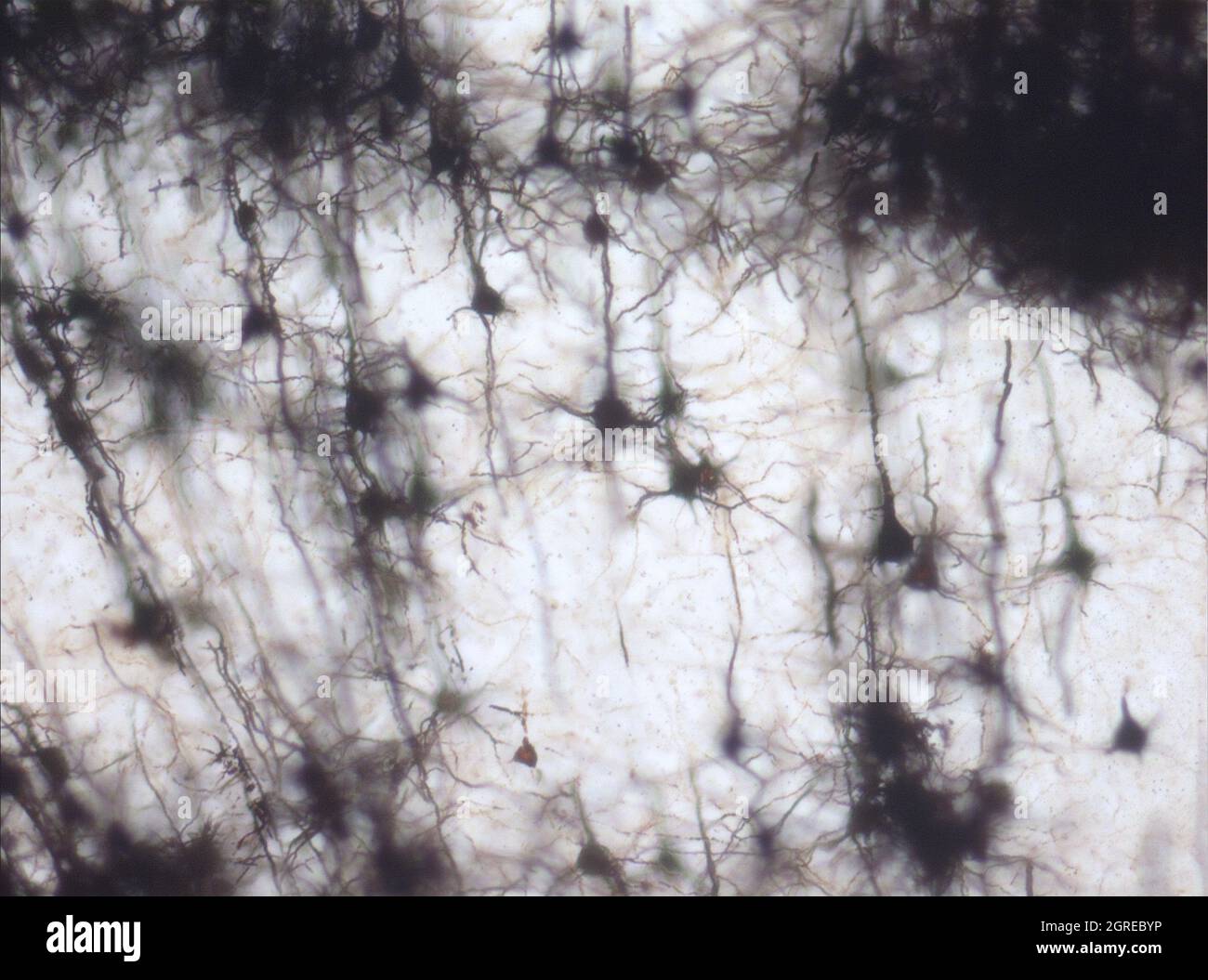 La section du cerveau de la souris a été colorée avec la coloration de Golgi, une technique du XIXe siècle qui a été largement utilisée jusqu'à récemment - et est parfois encore. Banque D'Images