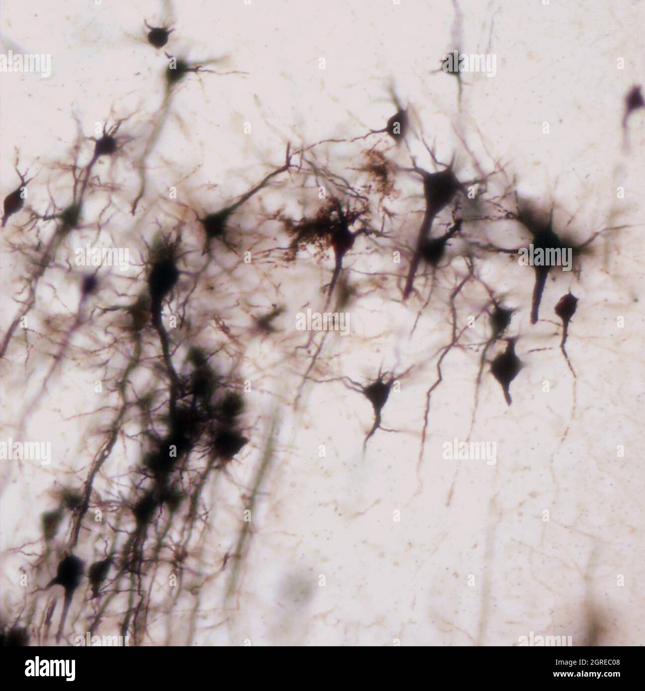 La section du cerveau de la souris a été colorée avec la coloration de Golgi, une technique du XIXe siècle qui a été largement utilisée jusqu'à récemment - et est parfois encore. Banque D'Images