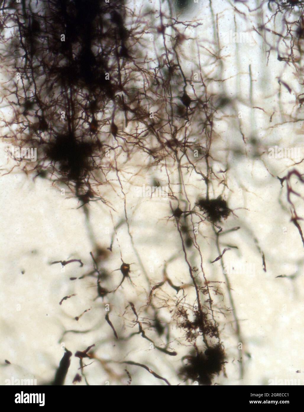 La section du cerveau de la souris a été colorée avec la coloration de Golgi, une technique du XIXe siècle qui a été largement utilisée jusqu'à récemment - et est parfois encore. Banque D'Images