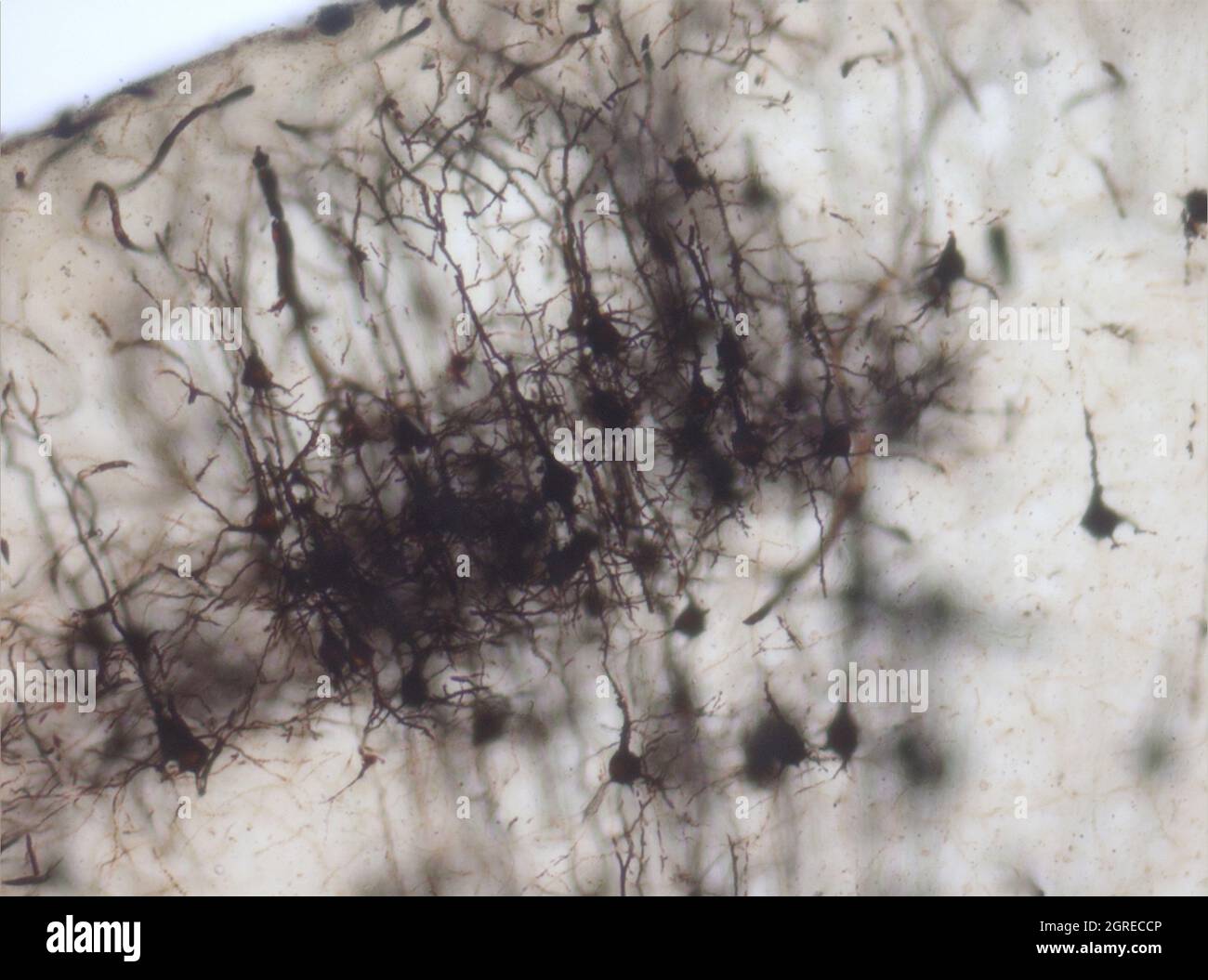 La section du cerveau de la souris a été colorée avec la coloration de Golgi, une technique du XIXe siècle qui a été largement utilisée jusqu'à récemment - et est parfois encore. Banque D'Images