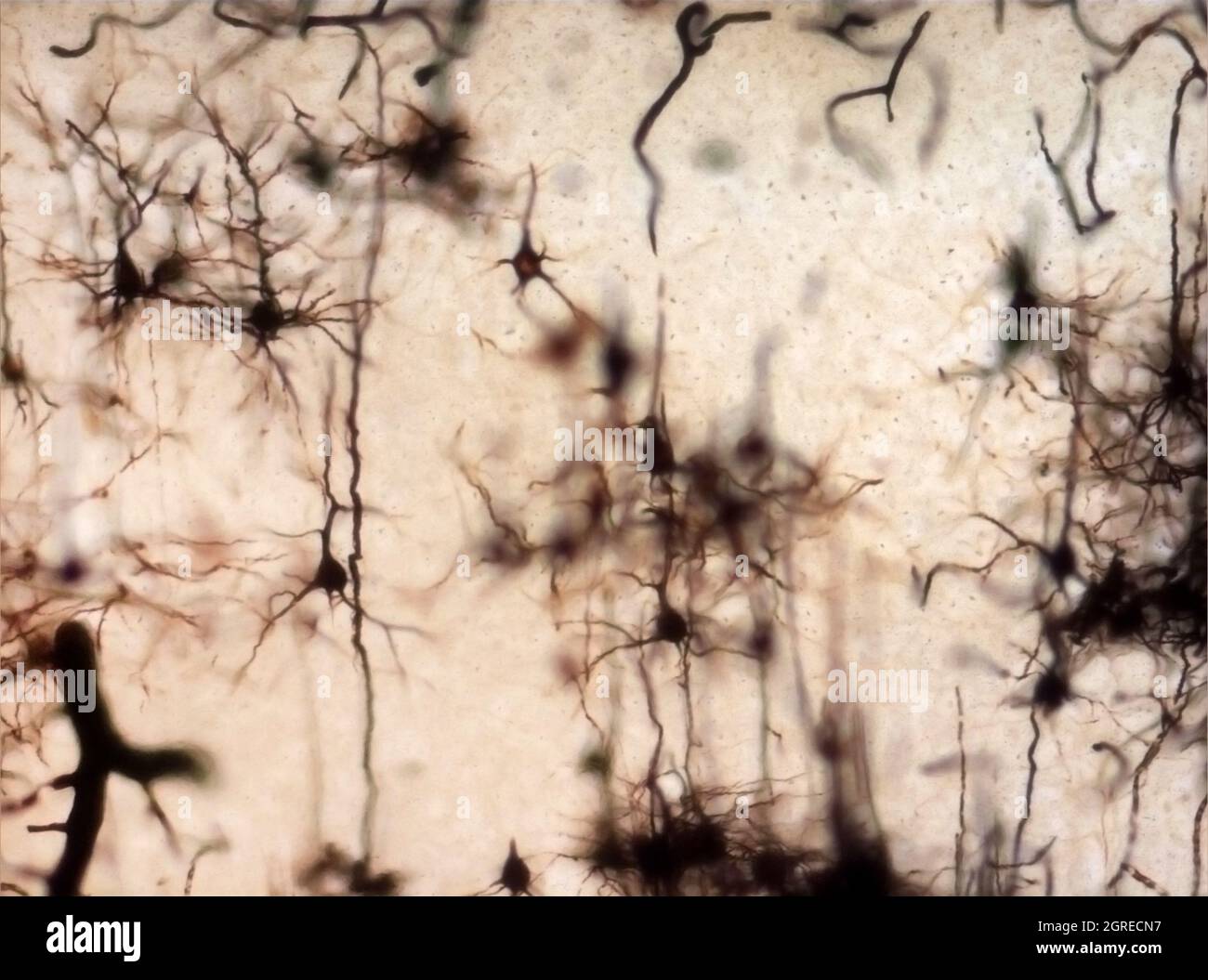 La section du cerveau de la souris a été colorée avec la coloration de Golgi, une technique du XIXe siècle qui a été largement utilisée jusqu'à récemment - et est parfois encore. Banque D'Images