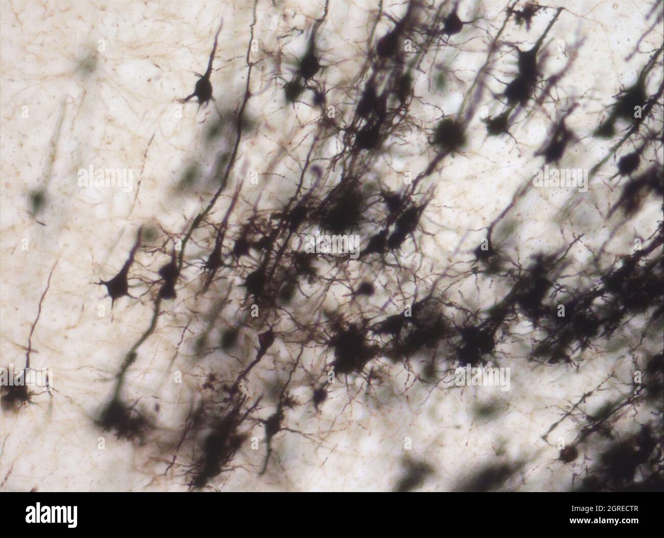 La section du cerveau de la souris a été colorée avec la coloration de Golgi, une technique du XIXe siècle qui a été largement utilisée jusqu'à récemment - et est parfois encore. Banque D'Images