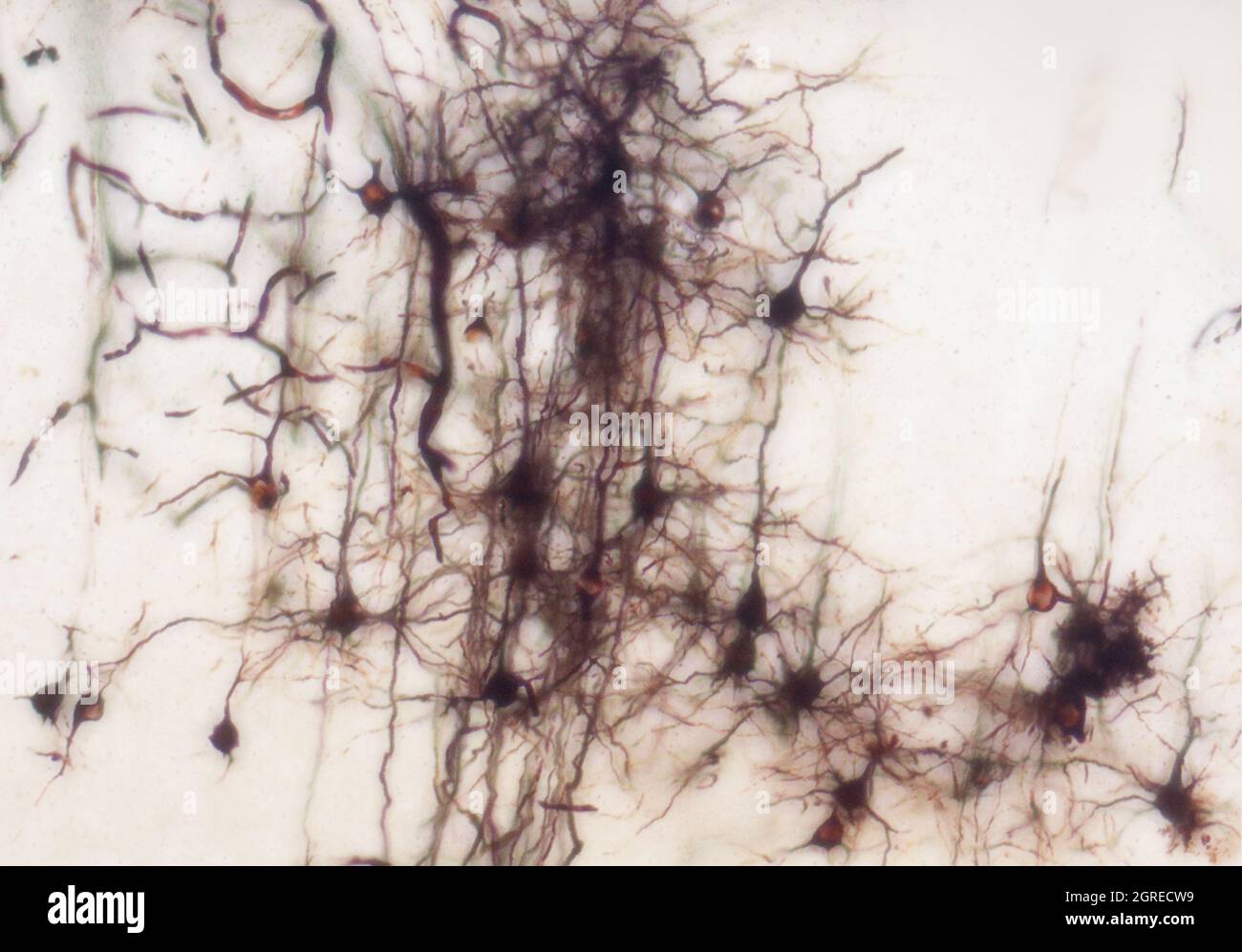 La section du cerveau de la souris a été colorée avec la coloration de Golgi, une technique du XIXe siècle qui a été largement utilisée jusqu'à récemment - et est parfois encore. Banque D'Images