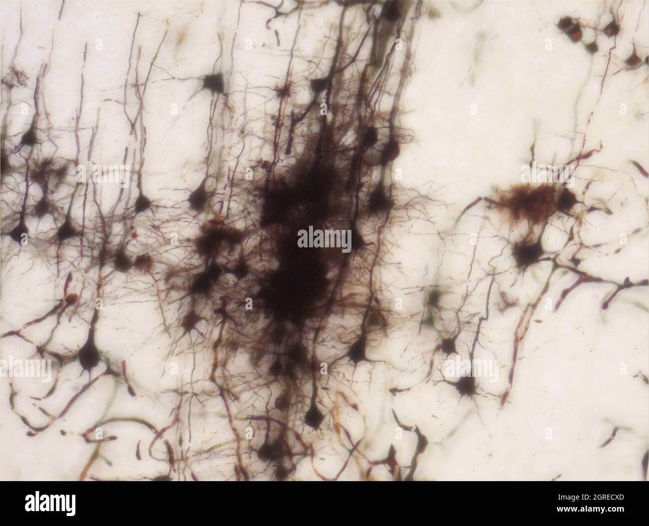 La section du cerveau de la souris a été colorée avec la coloration de Golgi, une technique du XIXe siècle qui a été largement utilisée jusqu'à récemment - et est parfois encore. Banque D'Images