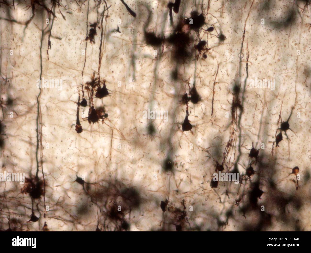 La section du cerveau de la souris a été colorée avec la coloration de Golgi, une technique du XIXe siècle qui a été largement utilisée jusqu'à récemment - et est parfois encore. Banque D'Images