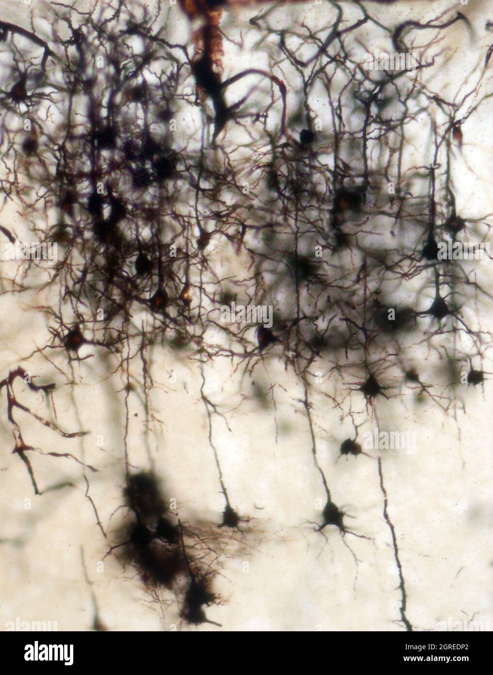La section du cerveau de la souris a été colorée avec la coloration de Golgi, une technique du XIXe siècle qui a été largement utilisée jusqu'à récemment - et est parfois encore. Banque D'Images