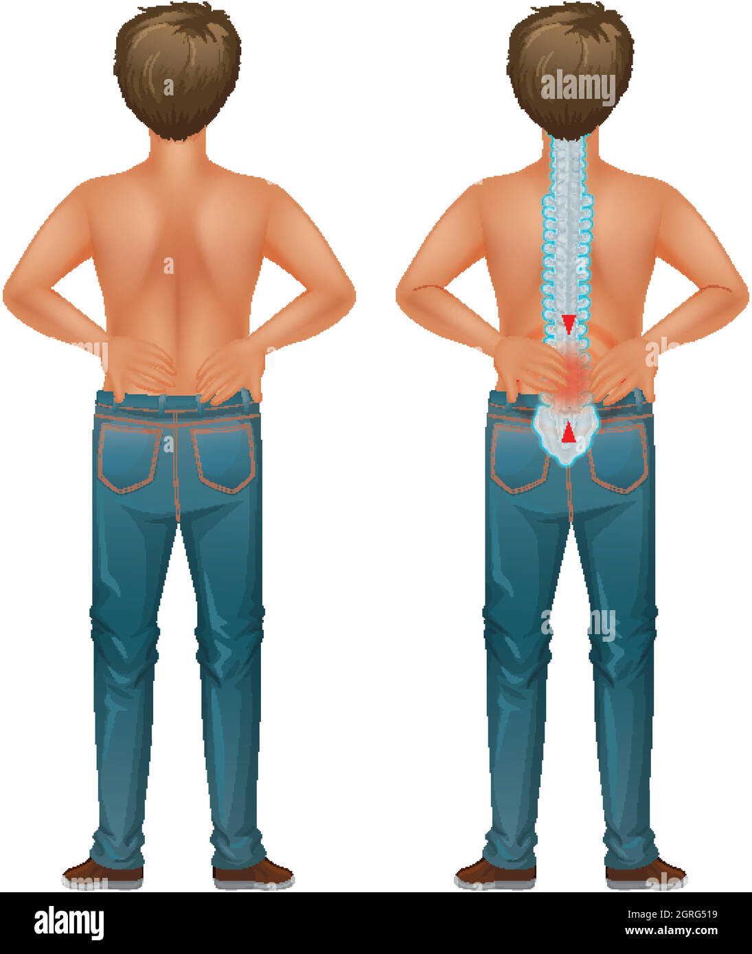 Homme humain souffrant de douleurs dorsales Illustration de Vecteur