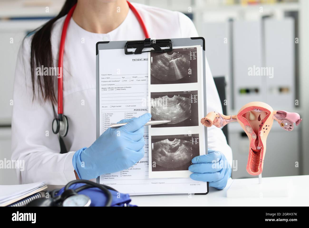 Le gynécologue montre une échographie de l'utérus dans le bureau de près Banque D'Images