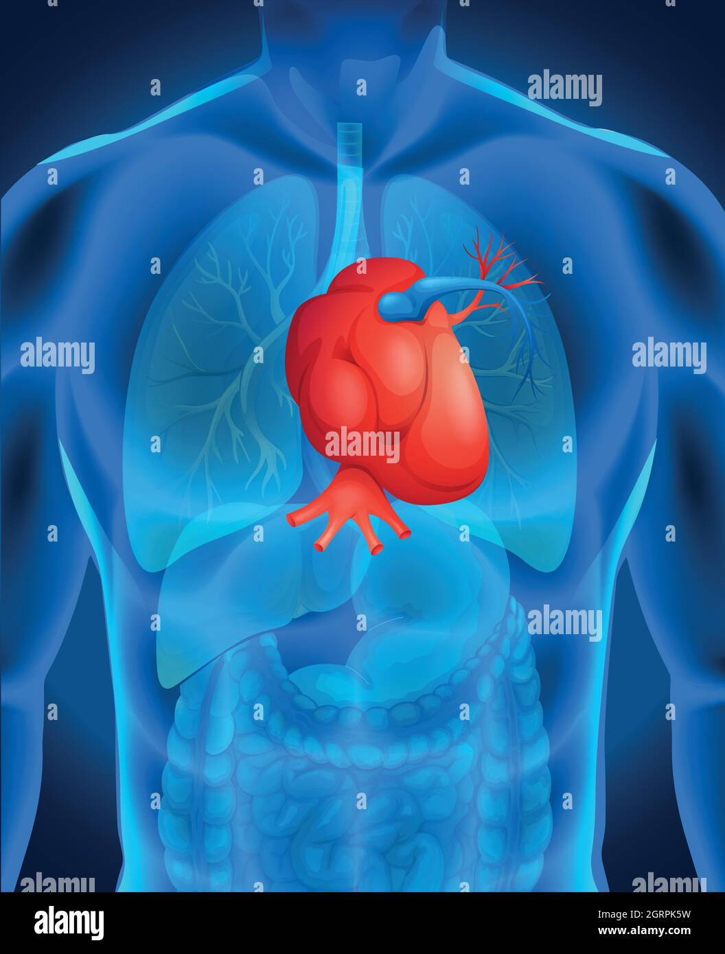 Diagramme de la maladie cardiaque chez l'homme Illustration de Vecteur