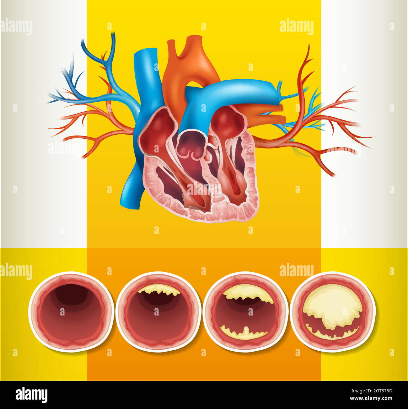 Anatomie cardiaque et graisse dans la veine Illustration de Vecteur