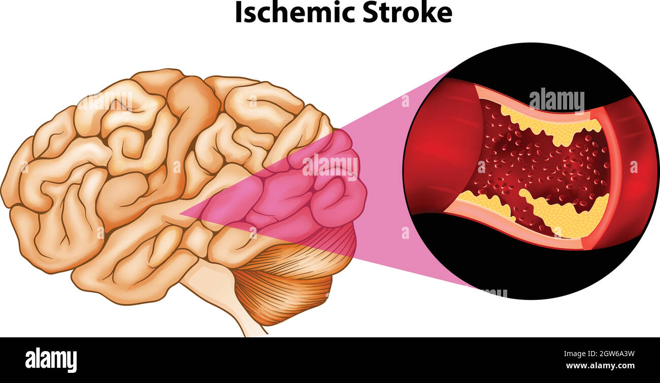 Cerveau Illustration de Vecteur