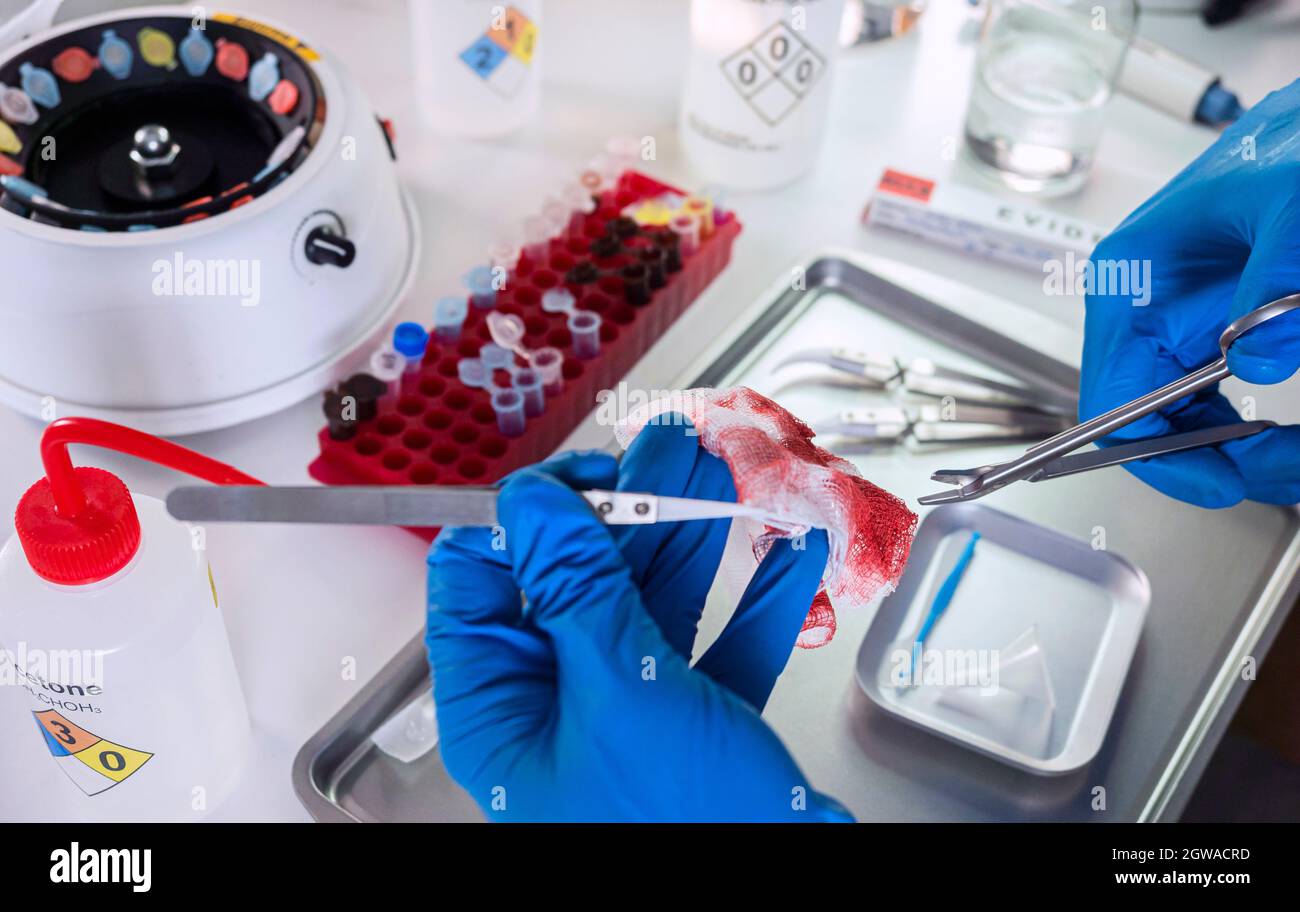 Un scientifique de police examine la gaze colorée par le sang d'un cas de surdosage de drogue, image conceptuelle Banque D'Images
