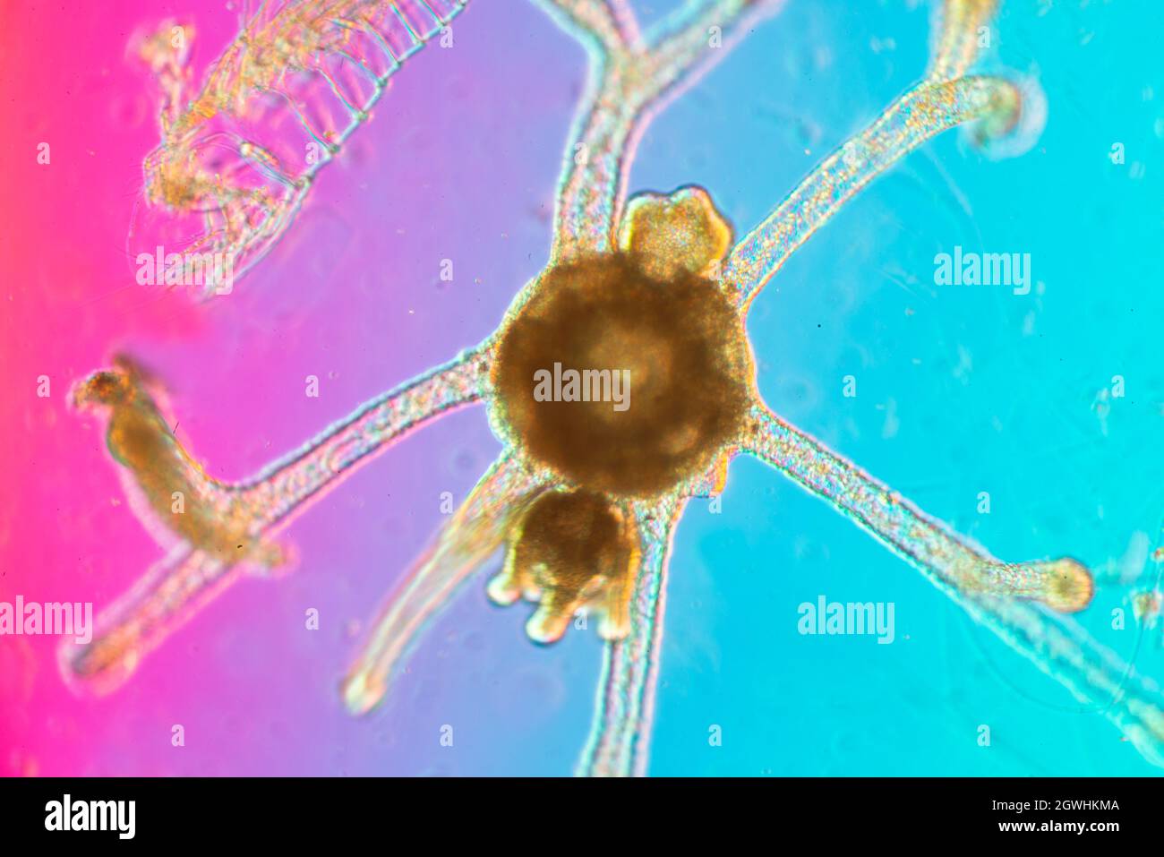 Anémone de mer (microscope) Banque D'Images