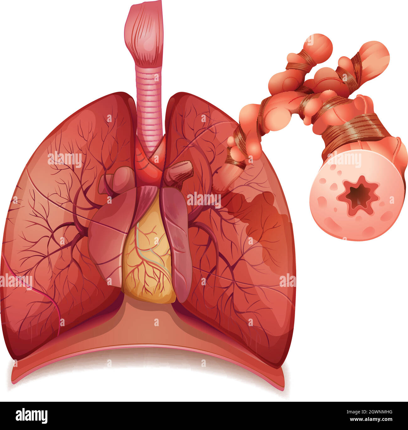 Asthme Illustration de Vecteur