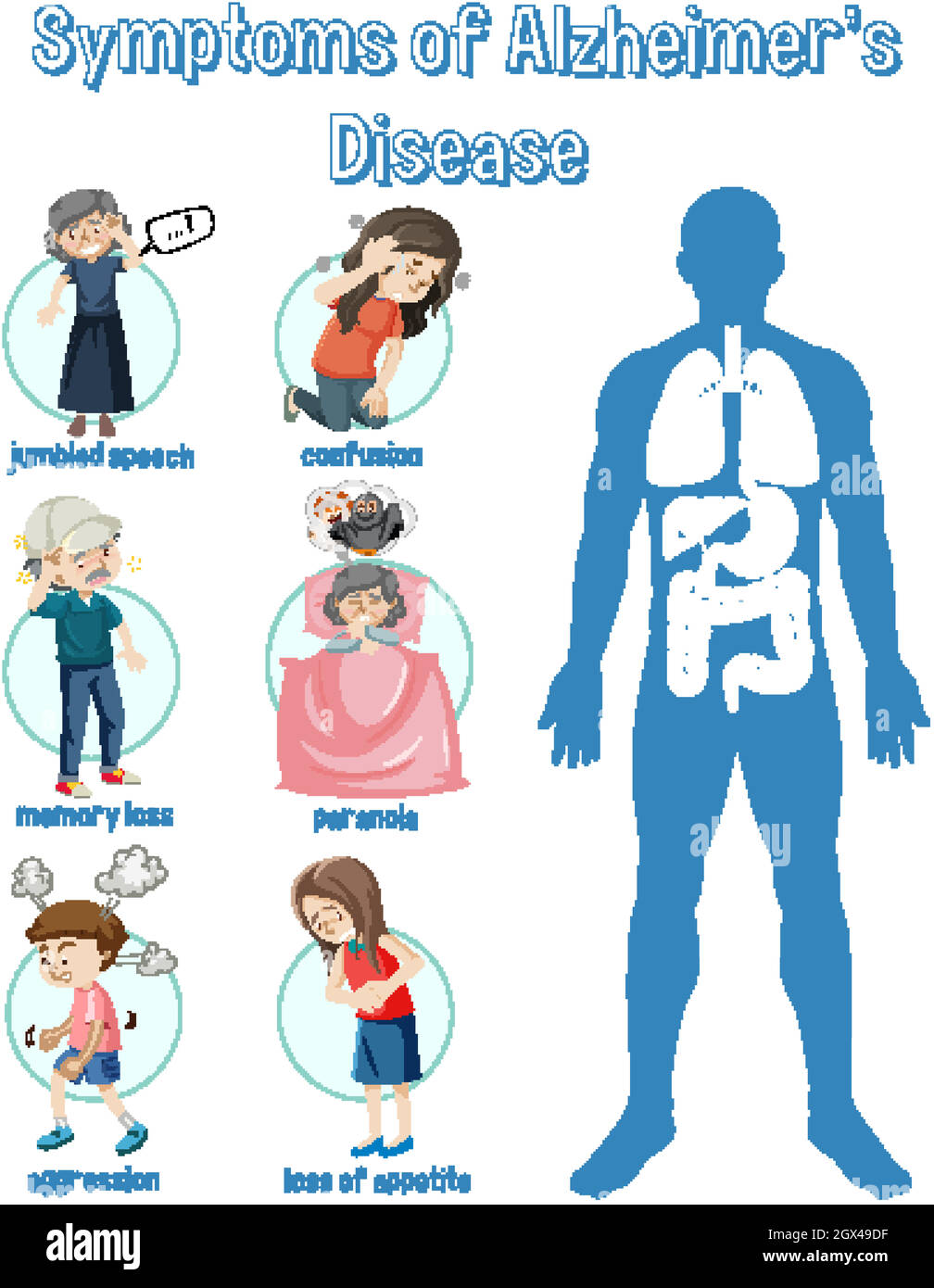 Infographie sur les symptômes de la maladie d'Alzheimer Image ...