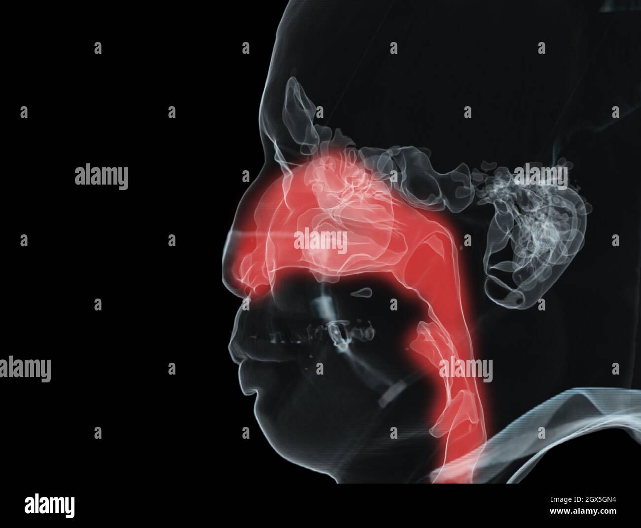 Anatomie des sinus paranasaux et des voies aériennes de la trachée illustration 3D . Banque D'Images