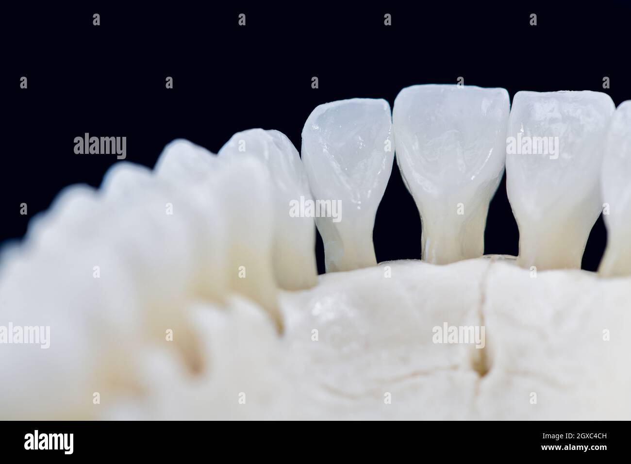 La mâchoire inférieure de l'anatomie des dents avec illustration médicale modèle isolé sur fond noir. Des dents en bonne santé, les soins dentaires et orthodontiques concept Banque D'Images