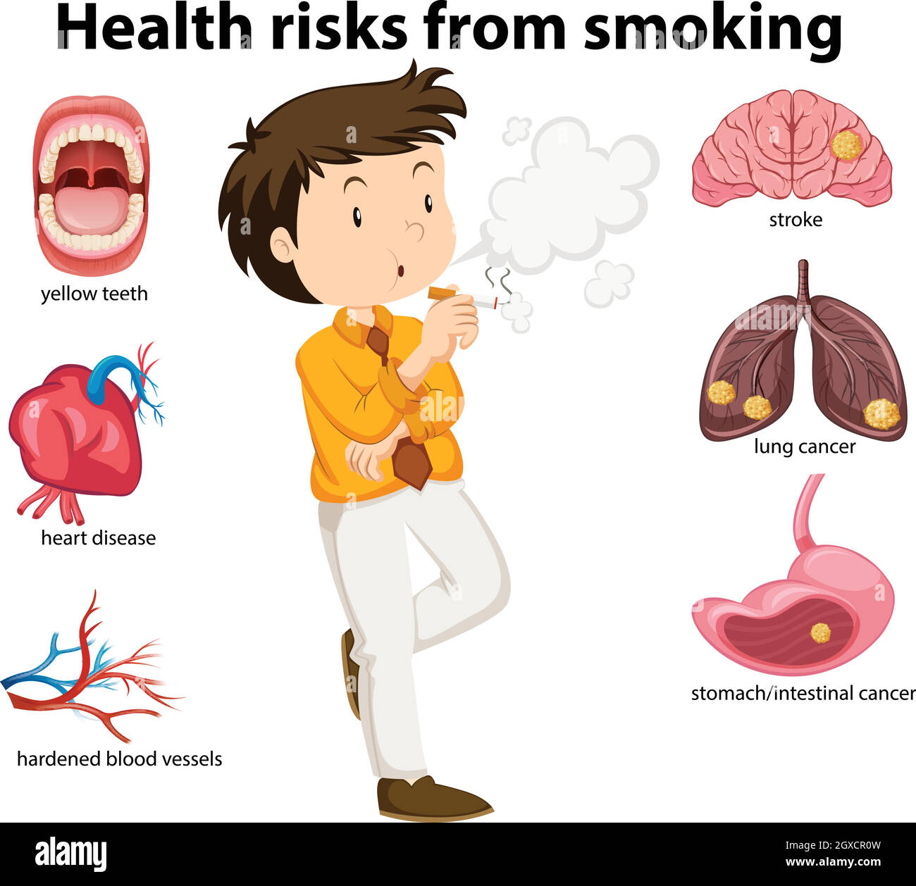 Une affiche d'éducation sur le tabagisme et la santé Illustration de Vecteur