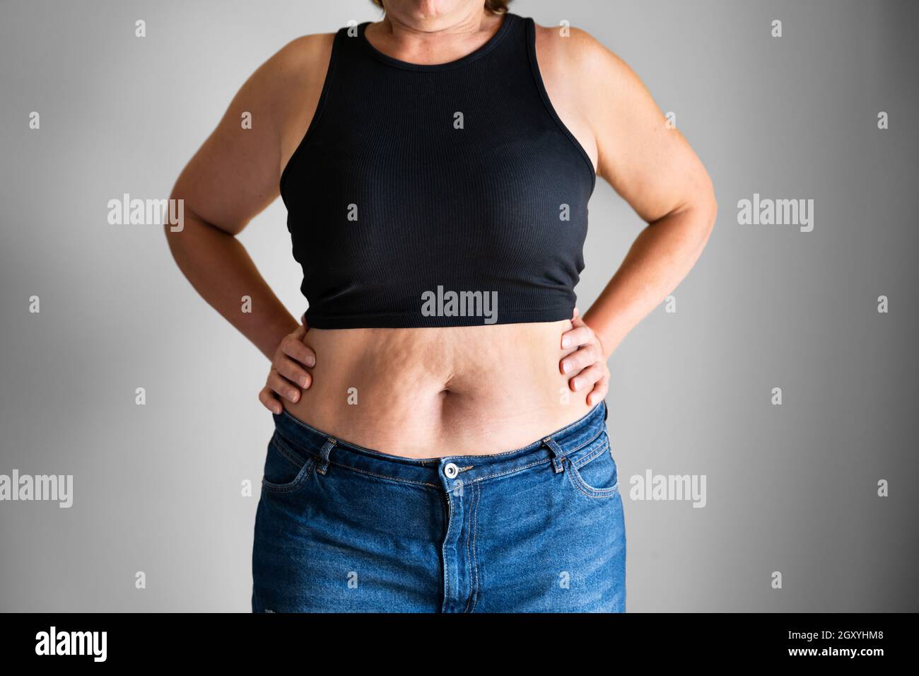FAT Woman Belly bouton et corps sur régime Banque D'Images