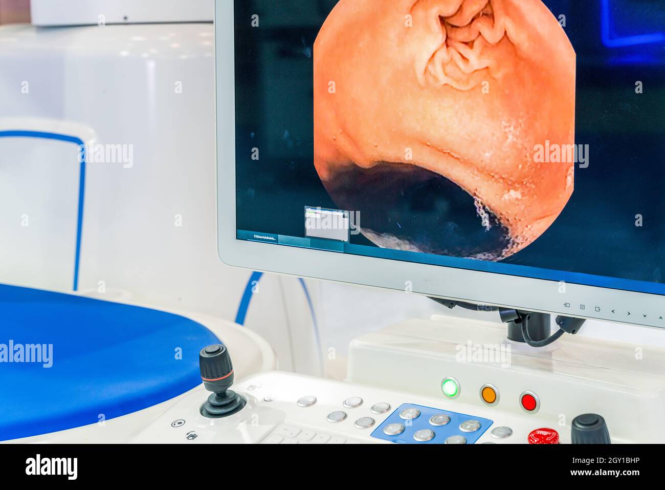 Moniteur avec une vue rapprochée de la plate-forme d'opération d'endoscopie Capsule dans l'hôpital Banque D'Images