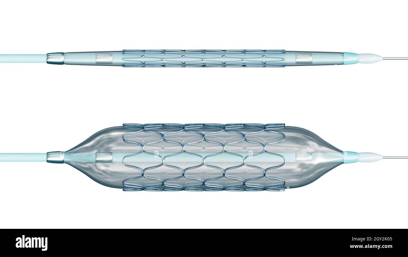 Stent déployé et collapsé prêt pour l'angioplastie isolé sur fond blanc illustration du rendu 3D.Médical, chirurgie, cardiologie, médecine, science-fiction Banque D'Images
