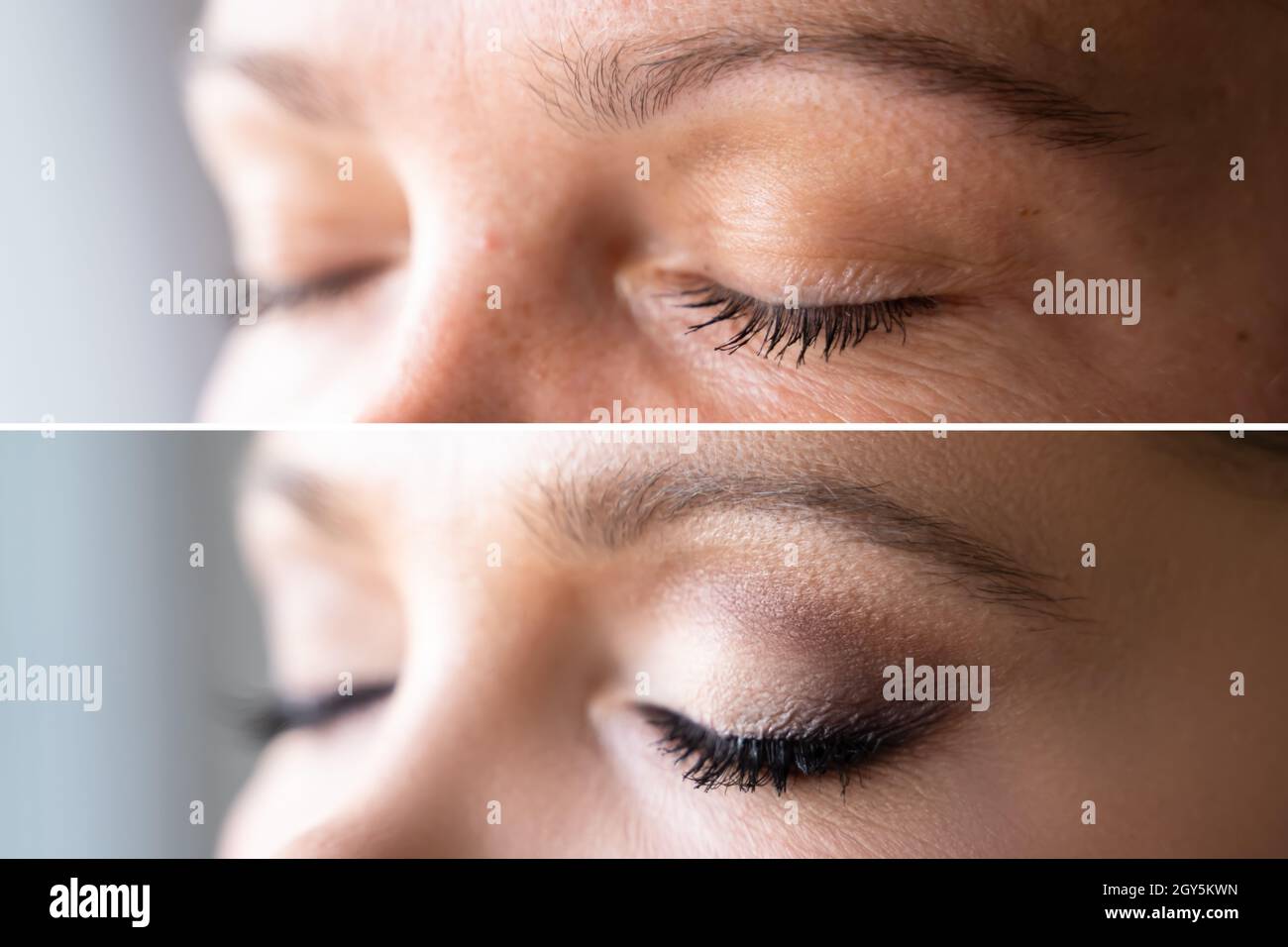 Femme visage peau maquillage. Comparaison avant et après Banque D'Images