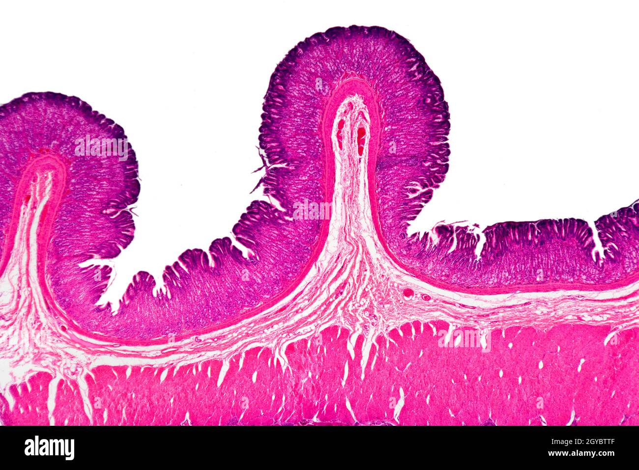 Section de lame de corps ventricule, photomicrographe à fond clair, section colorée Banque D'Images