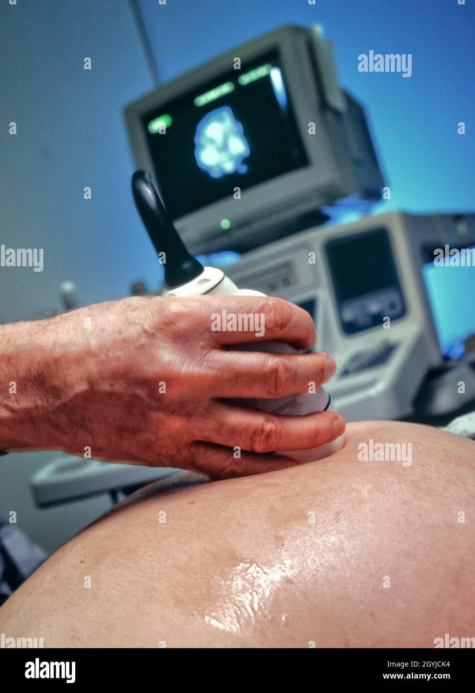 Échographie sur une femme enceinte utilisant la technologie 3-D Kretz Banque D'Images