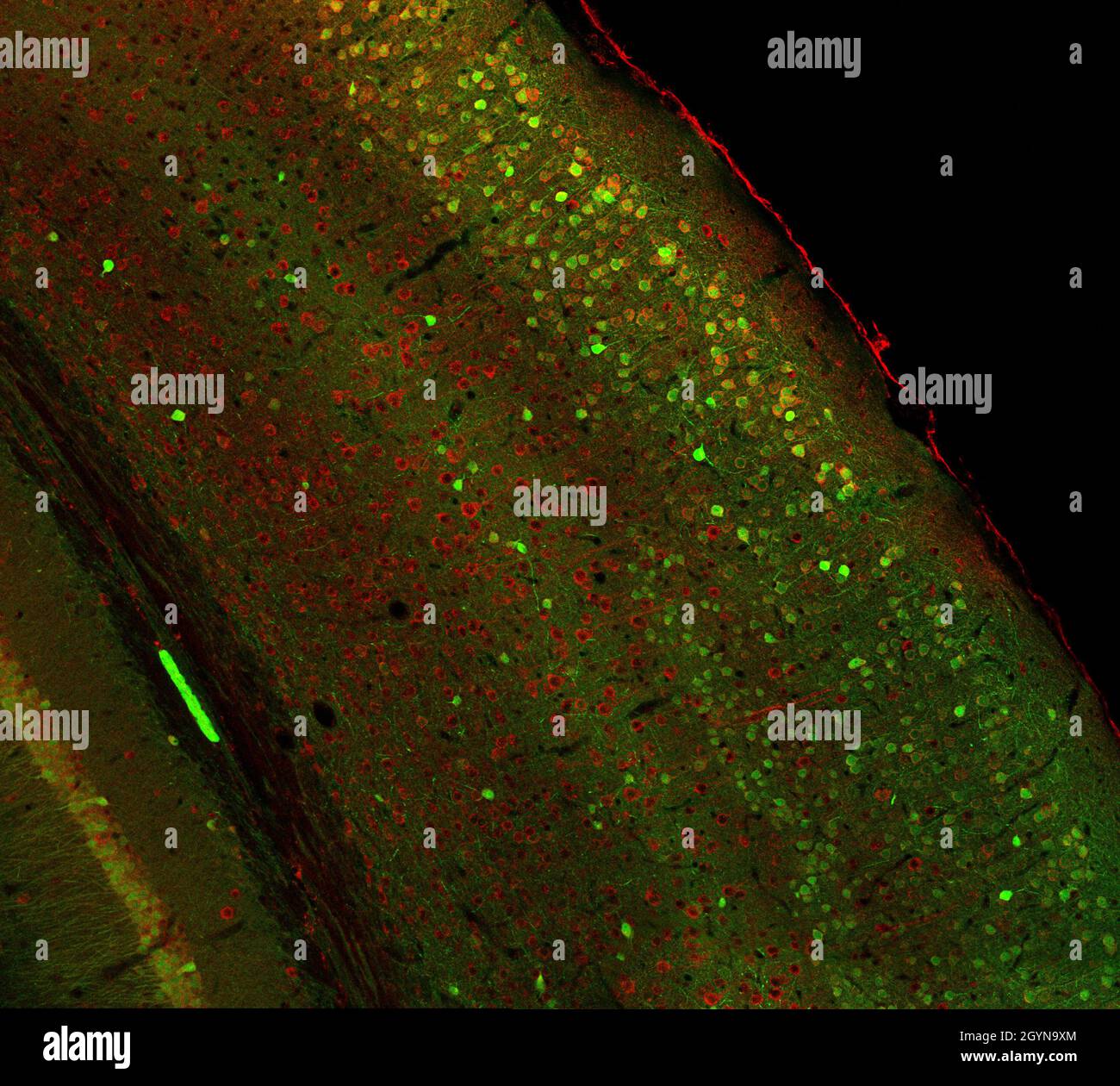 Cortex cérébral et partie de l'hippocampe sous elle dans une section d'un cerveau de souris, marqué par immunofluorescence et enregistré avec laser confocal Banque D'Images Cortex cérébral et partie de l'hippocampe sous elle dans une section d'un cerveau de souris, marqué par immunofluorescence et enregistré avec laser confocal Banque D'Images