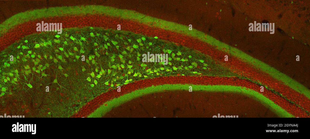 Section de l'hippocampe rostral de souris marquée par immunofluorescence et visualisée à l'aide d'un microscope à balayage laser confocal Banque D'Images