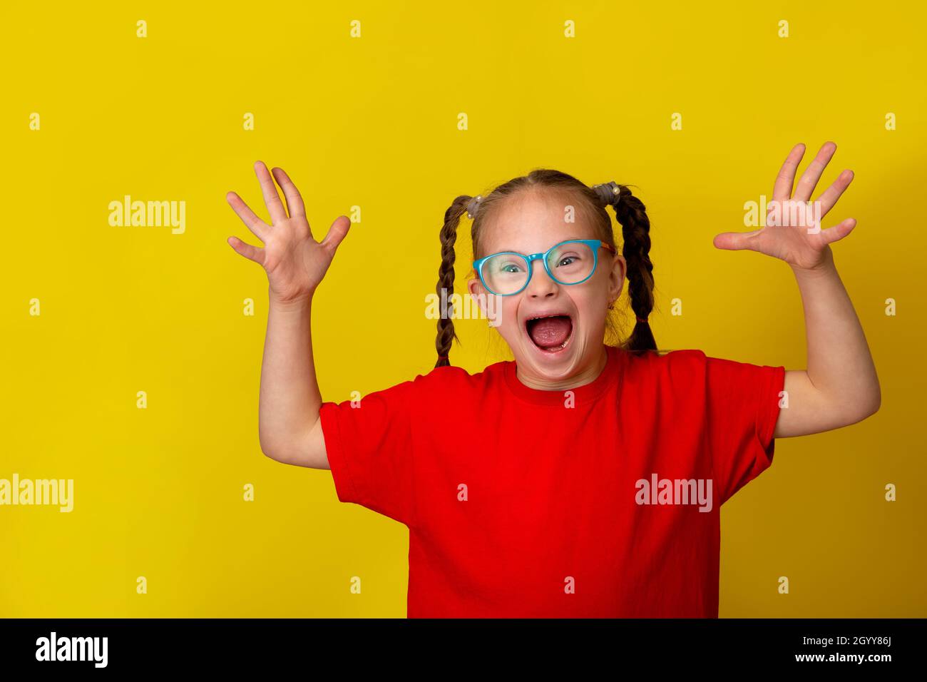 Fille heureuse avec le syndrome de Down.S'amuser, rire.Picots amusants.Studio.Portrait sur fond jaune Banque D'Images